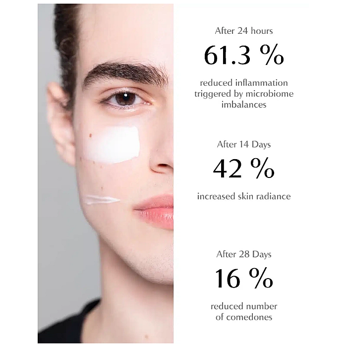 Crema de fata pentru ten acneic acne face cream