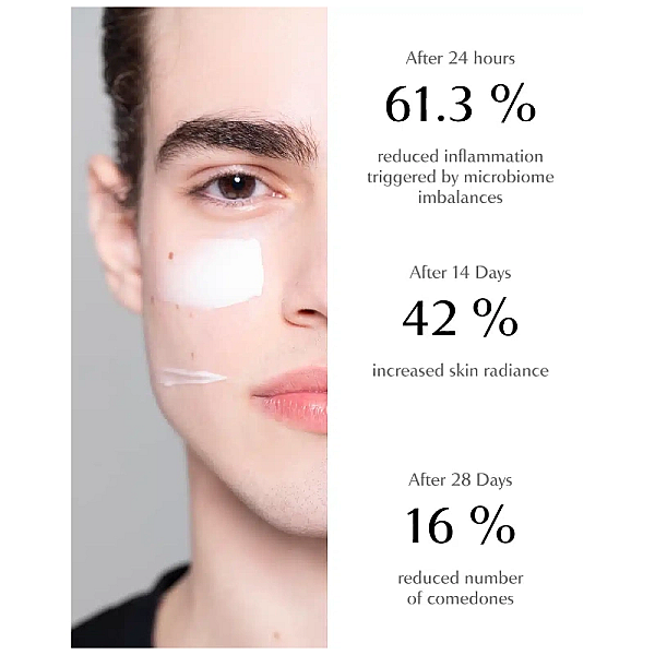Crema de fata pentru ten acneic acne face cream
