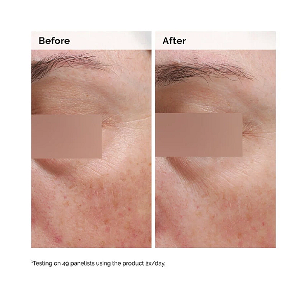 Emulsie cu niacinamide 5% pentru fata si corp