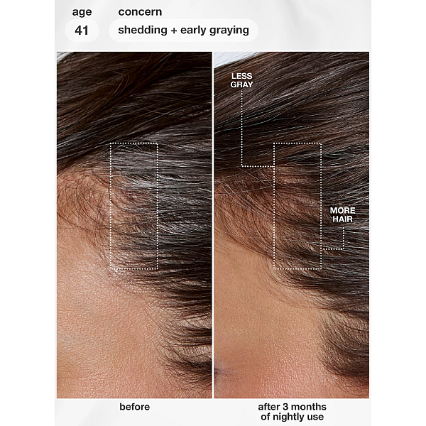 Ser de par FutureIQ cu efect de regenerare FutureIQ biomimetic hair longevity serum