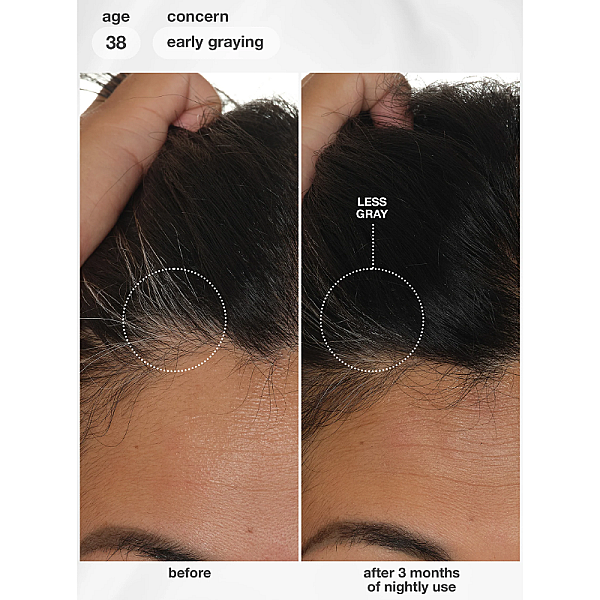Ser de par FutureIQ cu efect de regenerare FutureIQ biomimetic hair longevity serum