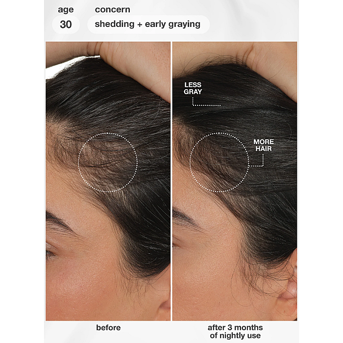 Ser de par FutureIQ cu efect de regenerare FutureIQ biomimetic hair longevity serum